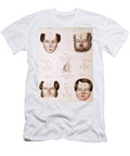 Nose Reconstruction 1815 Medical Text Science Source T-Shirt