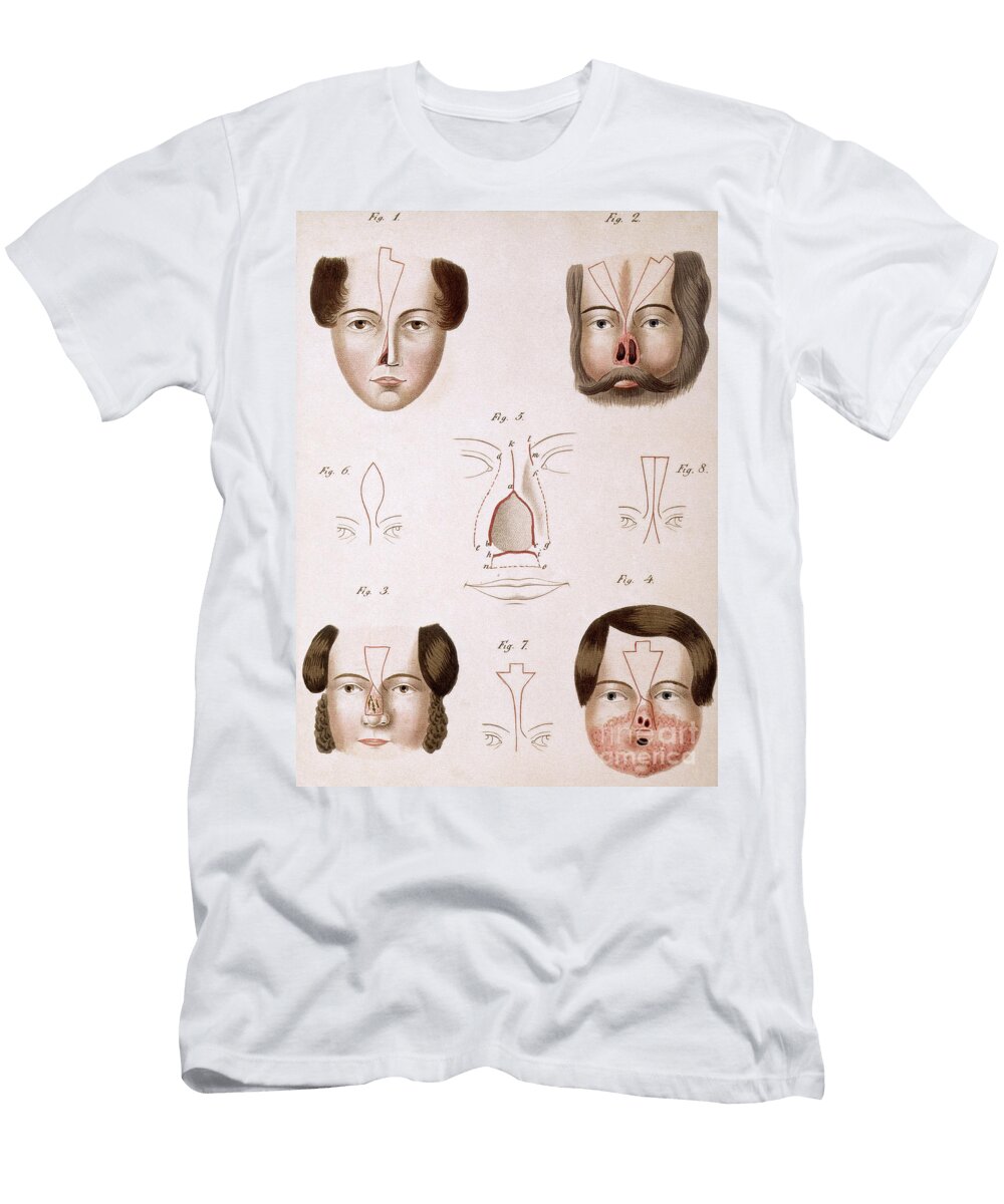 Nose Reconstruction 1815 Medical Text Science Source T-Shirt